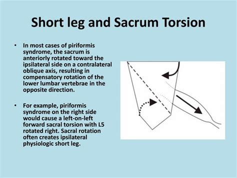 sacral test torsion|what causes sacral torsion.